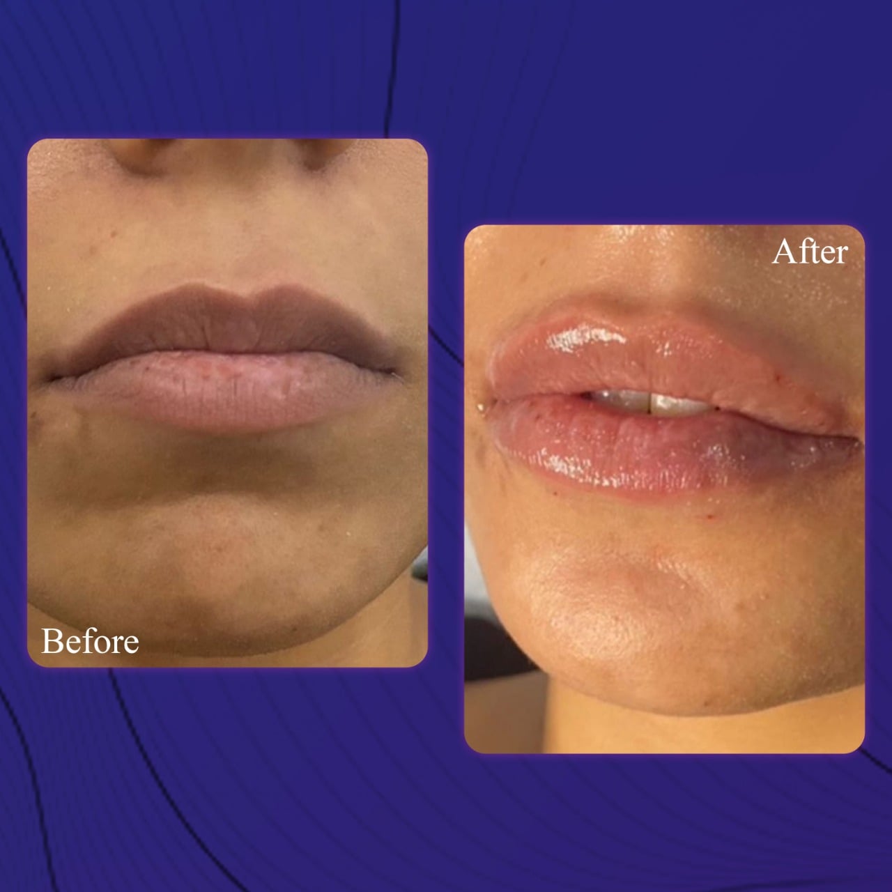 269844108_300675065275041_2723264811435681336_n