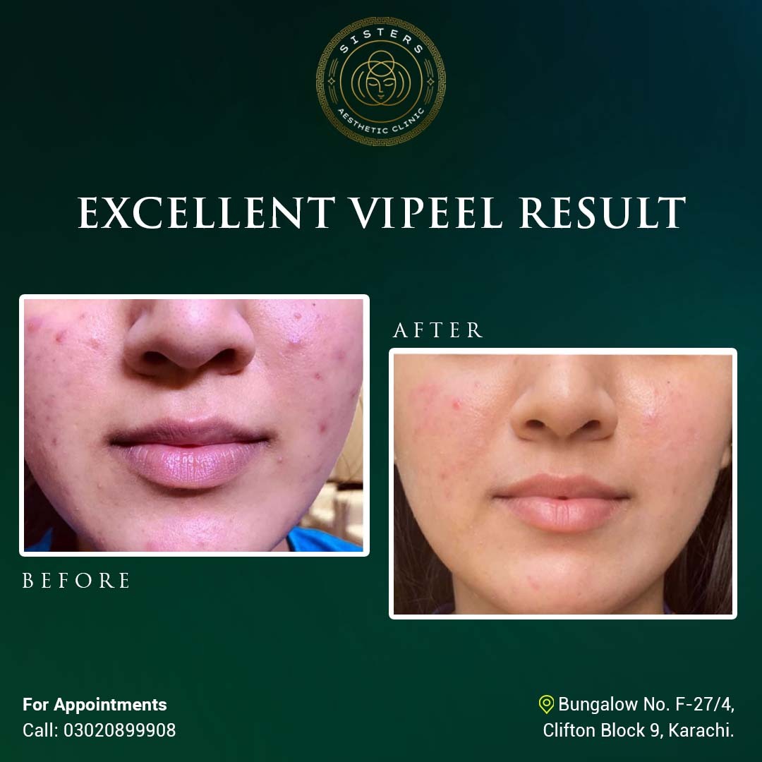 274654267_341738994501981_1237134625665729983_n